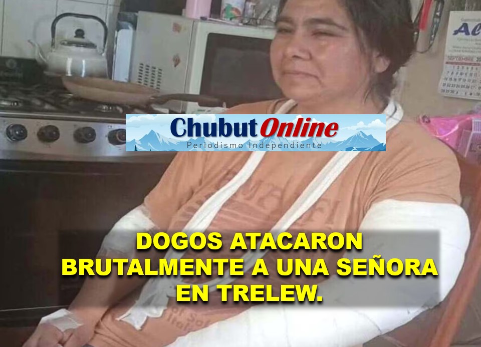 Mujer atacada por dos dogos en Trelew habló: «En dos segundos me cambió todo»